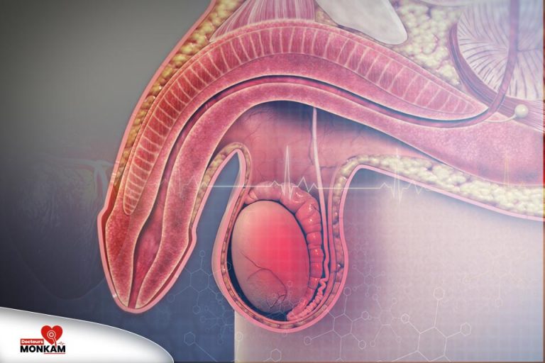 Dysfonction érectile et facteurs de risque cardiovasculaire