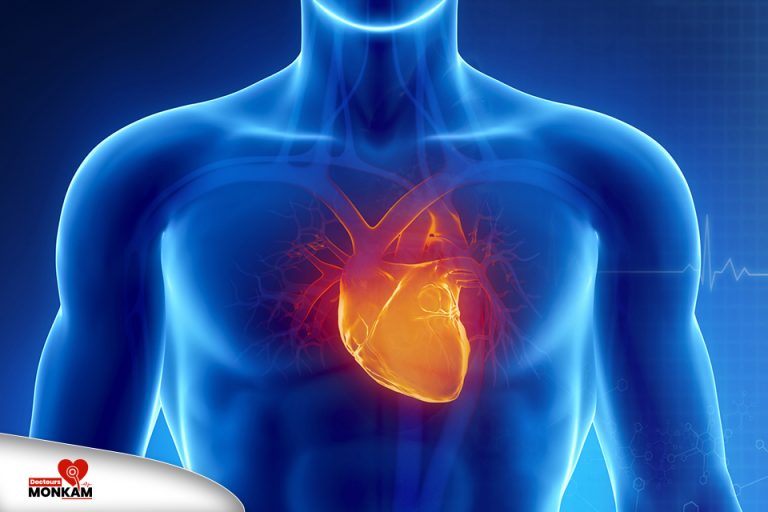 C'est quoi la cardiologie interventionnelle