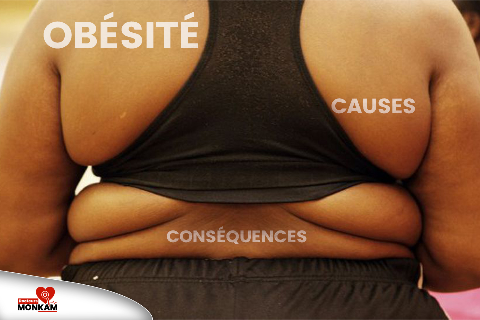 Obésité cause et conséquence