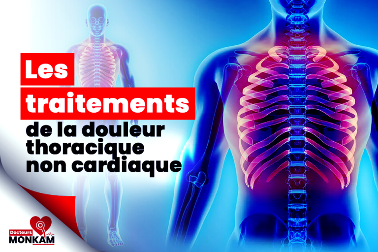 Les traitements de la douleur thoracique non cardiaque Docteurs Monkam