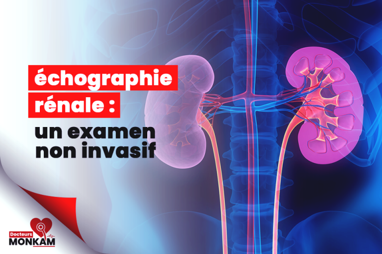 L&rsquo;échographie rénale : un examen non invasif pour diagnostiquer les problèmes rénaux