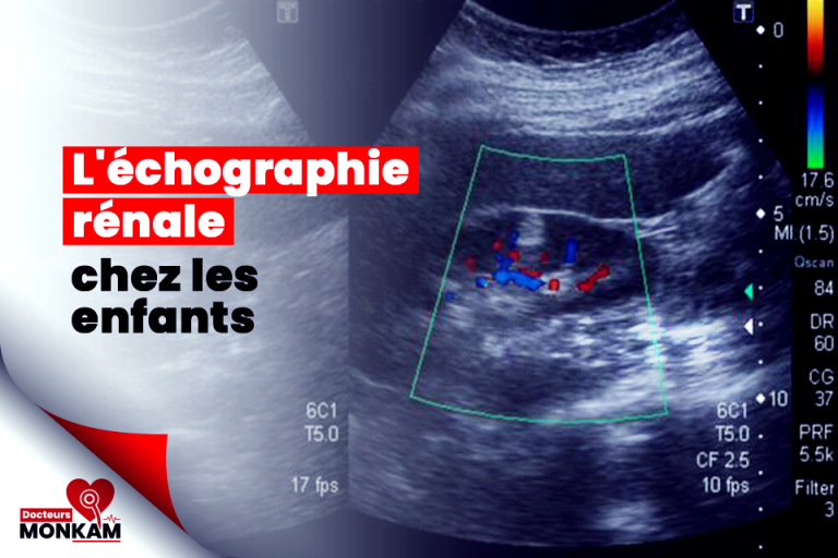 L'échographie rénale chez les enfants : ce que les parents doivent savoir