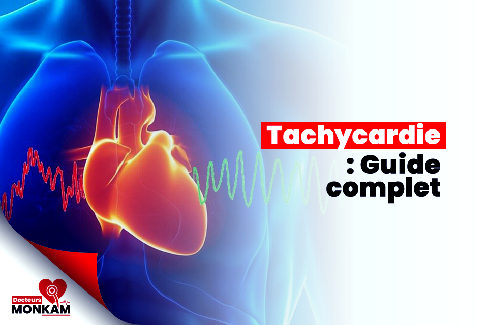 Tachycardie : symptômes, causes et traitements – Guide complet