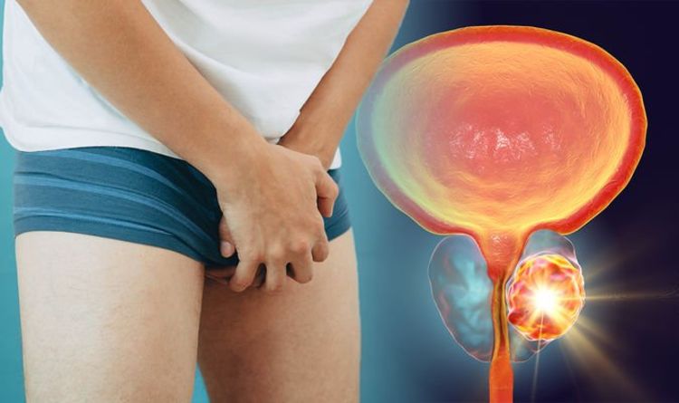 Cancer de la prostate : quels aliments pour le prévenir