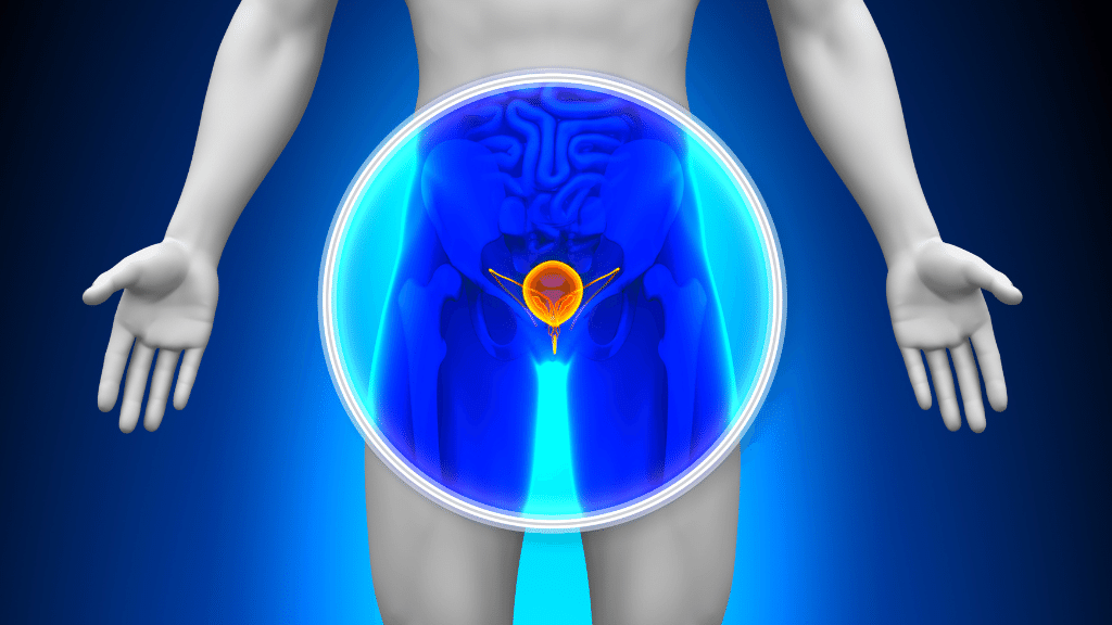 Cancer de la prostate : quels aliments pour le prévenir