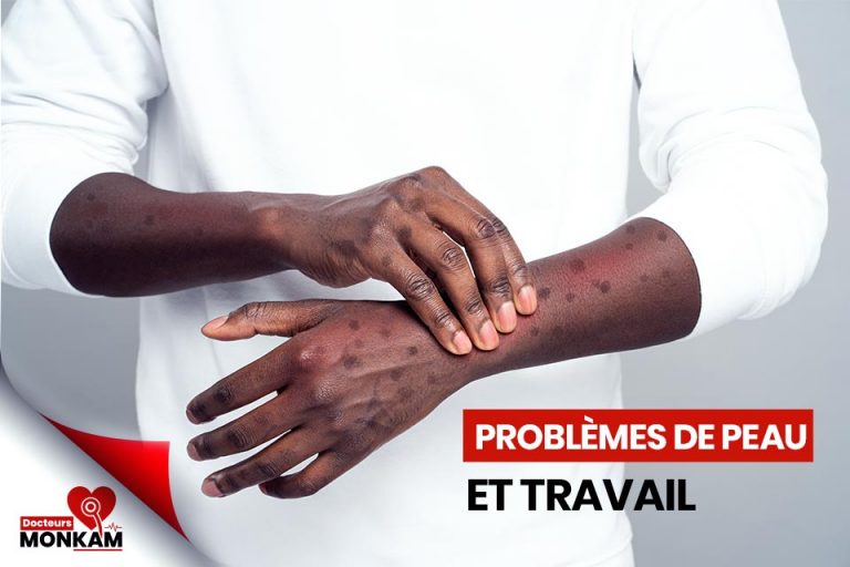 Problème de peau et travail