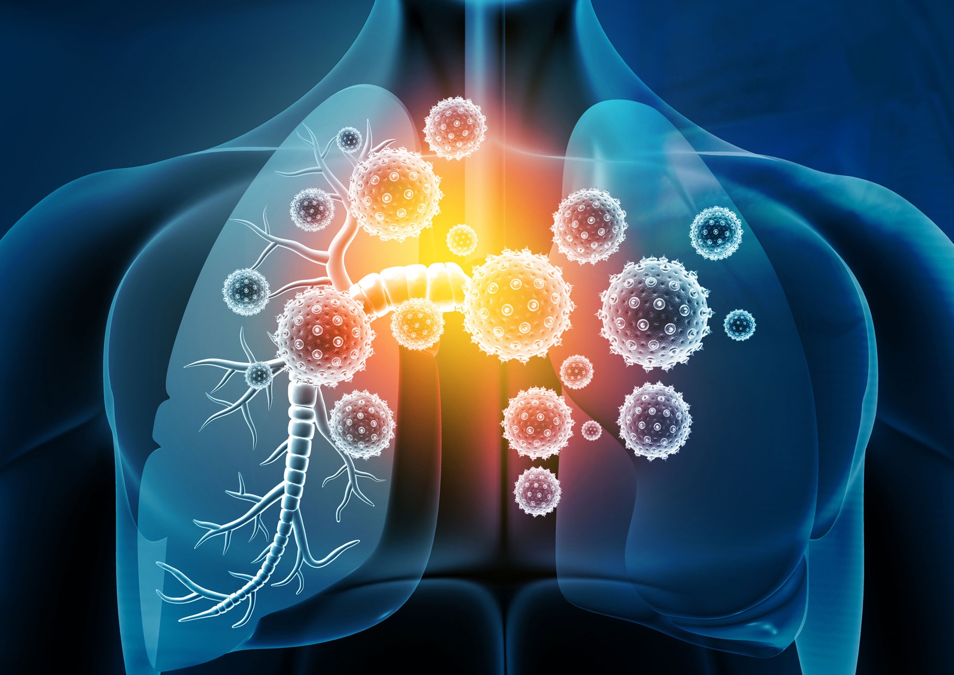 Infections respiratoires et toux