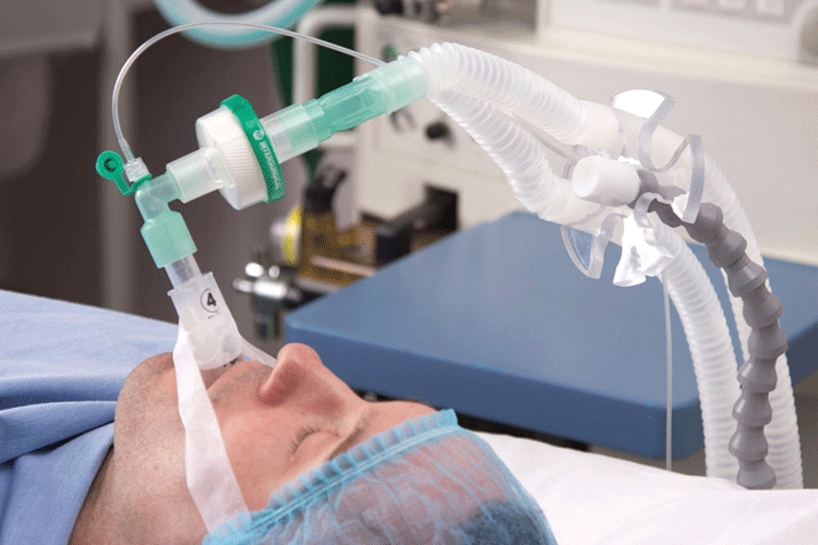 Manque d’oxygène : Causes, Symptômes et traitements 