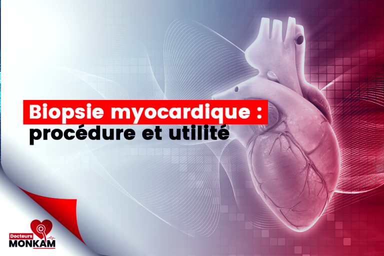 Biopsie myocardique : procédure et utilité