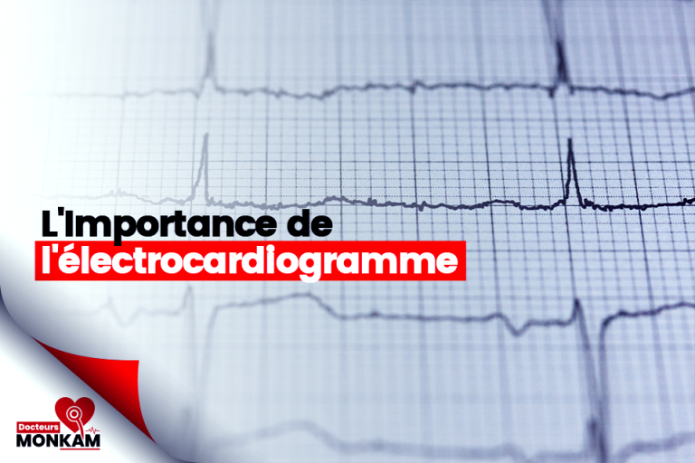 Quelle est l’importance de l’électrocardiogramme ?